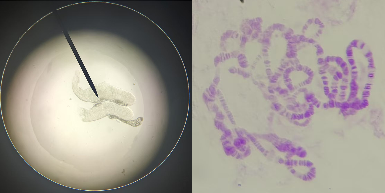 果蝇唾液腺和染色体 图片